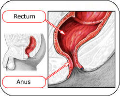 Rectum et anus Rectum et anus