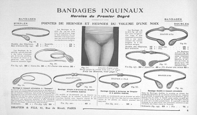 Hernie inguinale et de l'aine - Les bandages inguinaux