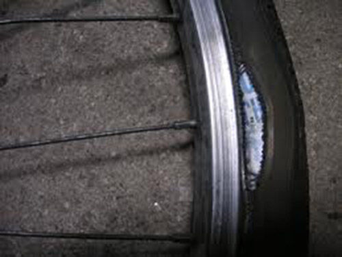 Comme sur un pneu, la hernie de l'aine s'extériorise à chaque effort de poussée..